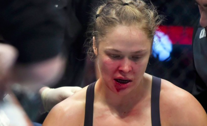 Rousey Breaks Silence: ‘Might Be 3-6 Months Before I Can Eat an Apple or Take An Impact’