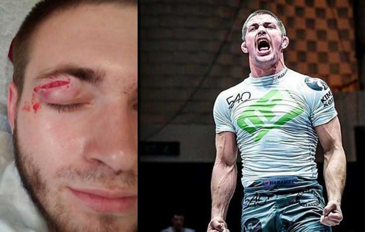 Gordon Ryan Out Of EBI 9 – Tonon Steps In As A Replacement