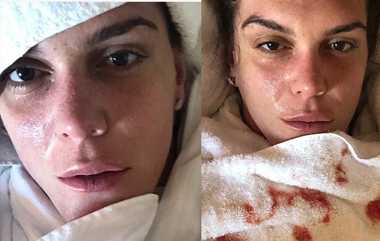 Gabi Garcia Shares Nosebleed evidence, Very Shaken Up About Rizin Bout Cancellation