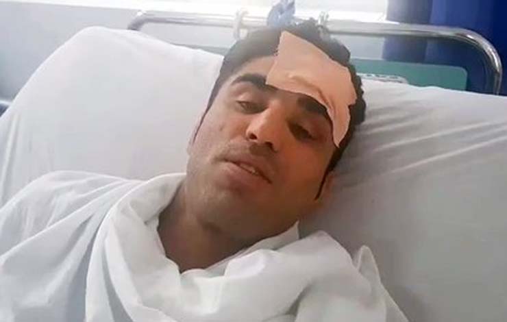 Afghan MMA fighter Survived Being Stabbed in the Head