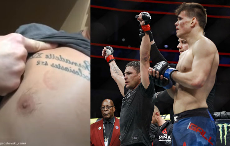 Did Mickey Gall try To Bite His Way Through Diego Sanchez To Avoid Loss?