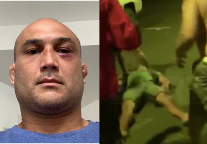 BJ Penn Comes Clean, Apologizes For His Recent Misbehaviors: ‘I Feel Embarrassed’