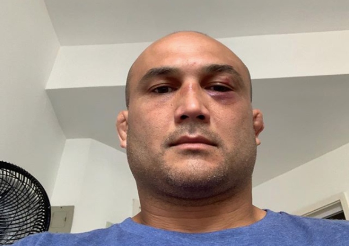 BJ Penn On His Future: ‘Fighting Is The Only Thing I Have Going On In My Life Right Now’