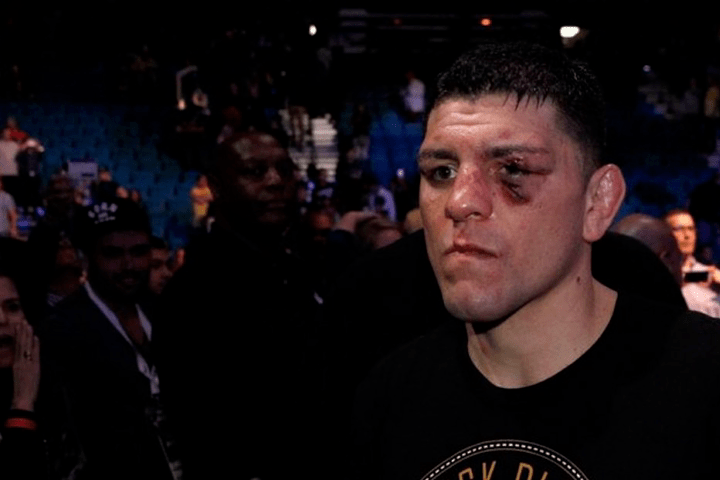 The Heartbreaking Story of Nick Diaz & His High School Girlfriend: “I’d Run Seven Miles to Her Grave Every Day”