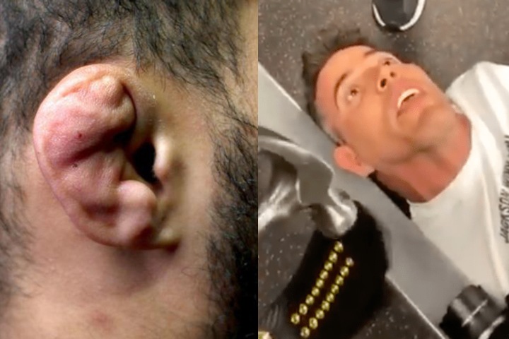 Steve-O Had UFC Fighters Try to Give Him Cauliflower Ear