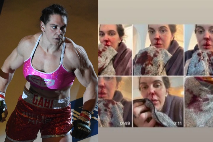 Gabi Garcia Gives More Details on Domestic Abuse Allegations: ‘He Elbowed Me in the Face while I was Sleeping’